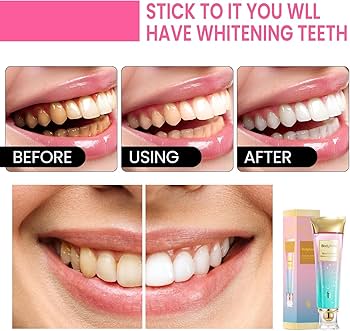 BodyAccel Niacinamide Whitening Toothpaste Niacinamide Toothpaste Stain Removal Toothpaste Natural Fresh Breath